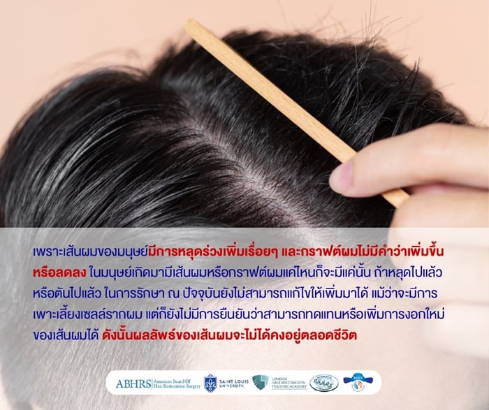 ต้องการให้เส้นผมอยู่ได้ตลอดชีวิต