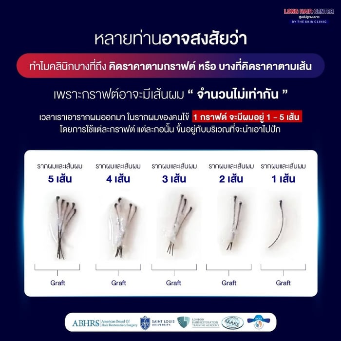 เรื่องที่หลายคนยังเข้าใจผิดเกี่ยวกับการปลูกผม?
