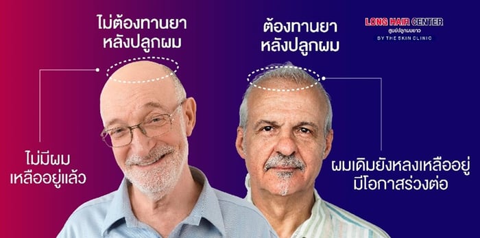 ทำไมบางเคสทานยา?