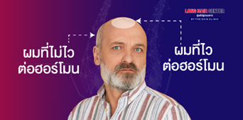 ทำความเข้าใจผมและฮอร์โมน