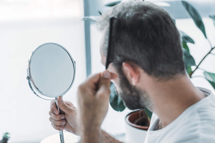Androgenetic Alopecia: Is it in fact Hereditary?