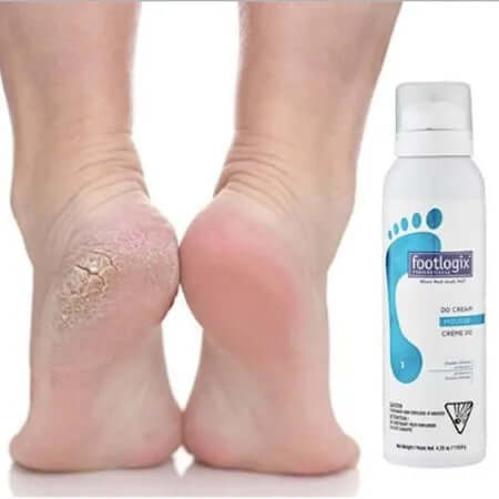 Footlogix DD Cream Mousse: Walk with Pride