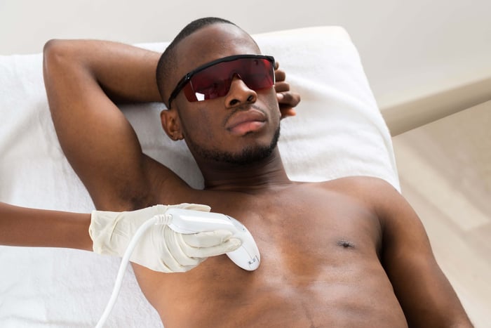 Unveiling the Smooth Revolution: The Ins and Outs of Laser Hair Removal