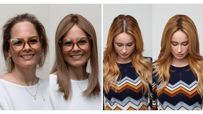 Image of two women; left displays thinning hair at the crown, right features thinning along the parting line.