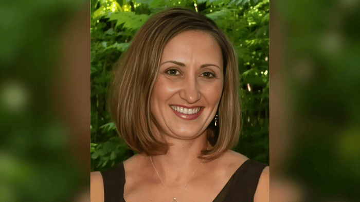 Sondra Dubas' before her hair loss.