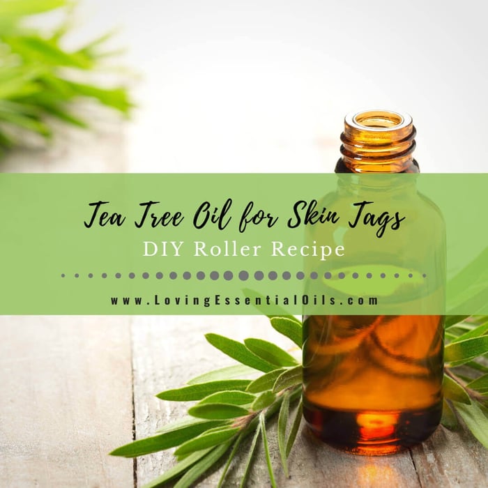 Tea Tree Oil for Skin Tags with DIY Roller Blend Recipe