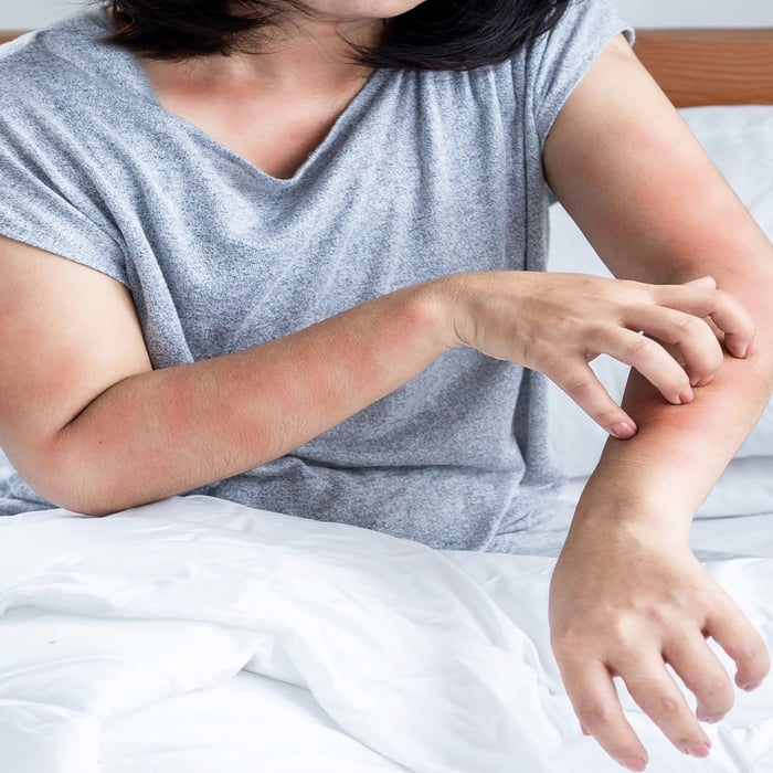 Person experiencing skin irritation in bed, a common sign of allergies when sleeping, scratching red patches on their arm in a bedroom setting.
