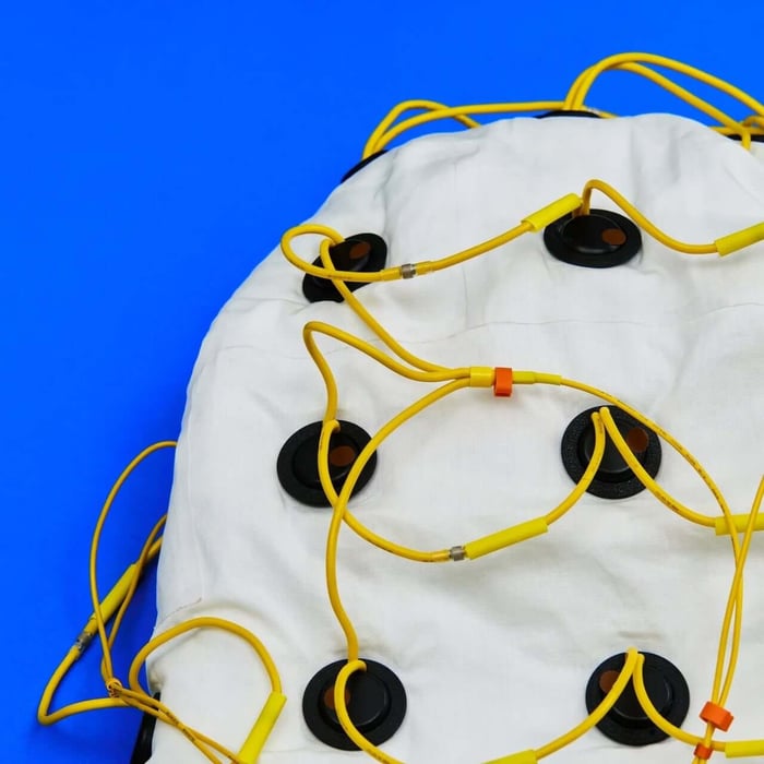 Exposed yellow wiring on jacket