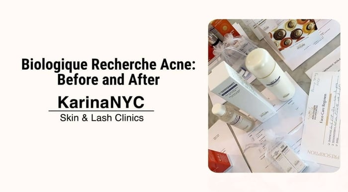 Biologique Recherche Acne Before and After: What to Expect