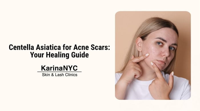 Centella Asiatica for Acne Scars: Your Healing Guide