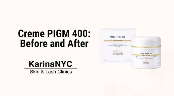 Creme PIGM 400 Before and After: The Pigment Fix