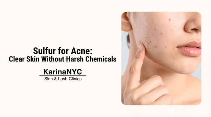 Sulfur for Acne: Clear Skin Without Harsh Chemicals