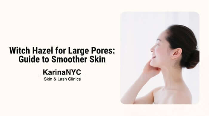 Witch Hazel for Large Pores: Guide to Smoother Skin