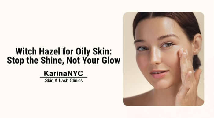 Witch Hazel for Oily Skin: Stop the Shine, Not Your Glow