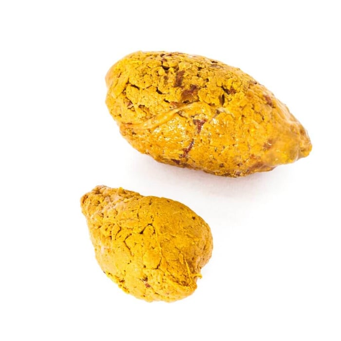 Liver problems (Jaundice)