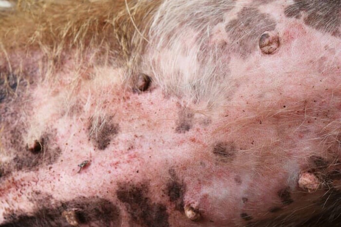 Heat Rash