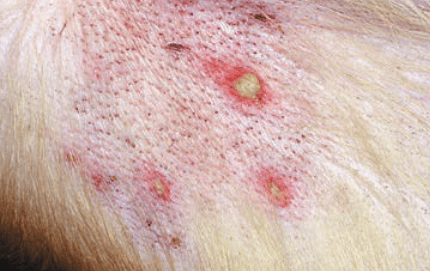 pustules white bumps from bacterial folliculitis