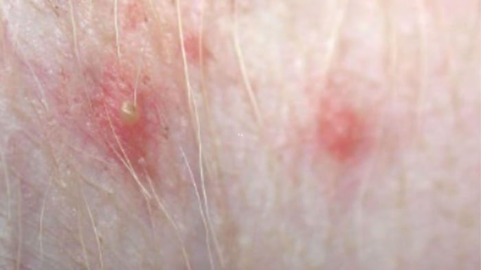 close up of pimples from folliculitis on dog skin