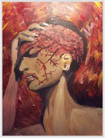 metabolism and migraine