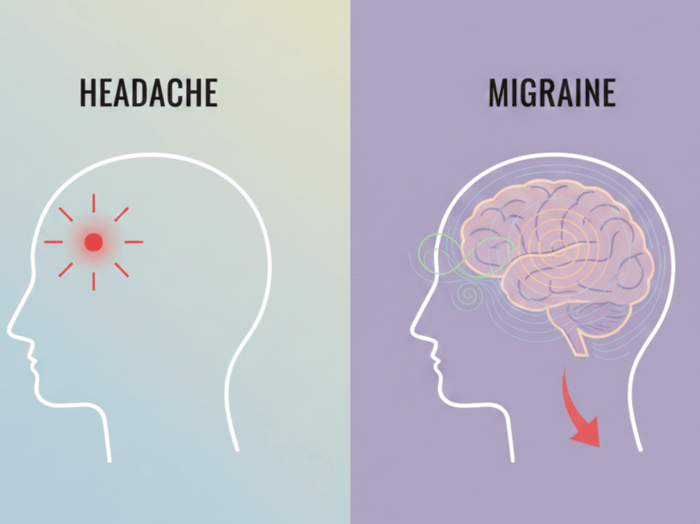 Migraine vs headache showing localized head pain versus broader brain involvement