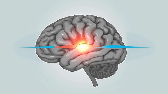 Illustration of cortical wave linked to migraine aura mechanism
