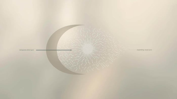 Common visual patterns seen during Migraine Aura