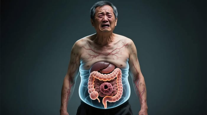 理解Colonadenocarcinoma
DLD-1癌症:研究、預防與支持資源全面指南