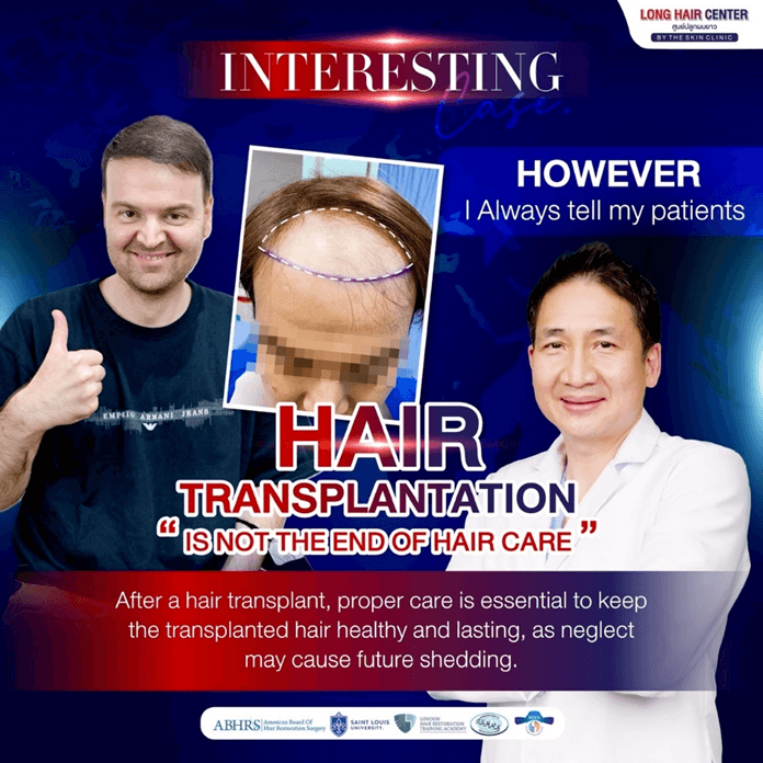 Hair Transplant in Thailand Review: German Patient’s with Long Hair FUI by Dr. Top Hair Hospital