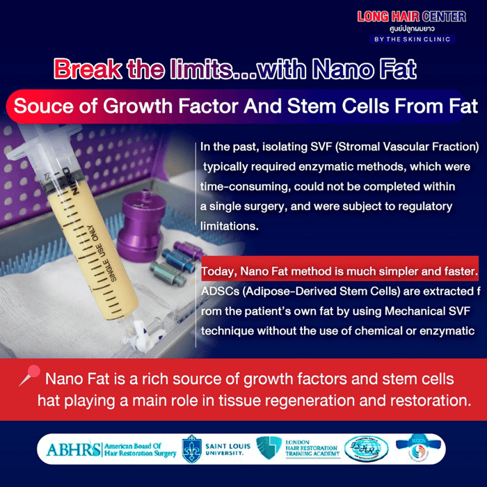 Using one’s own fat to restore hair, known as Nano Fat, is a groundbreaking innovation in the hair transplantation field that has gained significant attention. It delivers visible results with a high level of safety. This article will take you deeper into everything about Nano Fat. An appealing option for those facing hair loss or thinning. While uncovering why Nano Fat has become a key factor in enhancing the effectiveness of hair transplantation.
