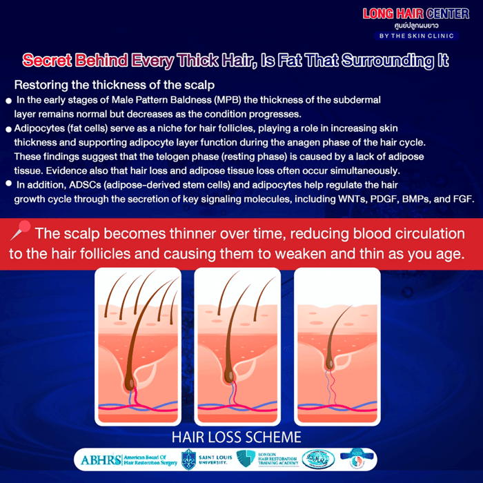 Using one’s own fat to restore hair, known as Nano Fat, is a groundbreaking innovation in the hair transplantation field that has gained significant attention. It delivers visible results with a high level of safety. This article will take you deeper into everything about Nano Fat. An appealing option for those facing hair loss or thinning. While uncovering why Nano Fat has become a key factor in enhancing the effectiveness of hair transplantation.