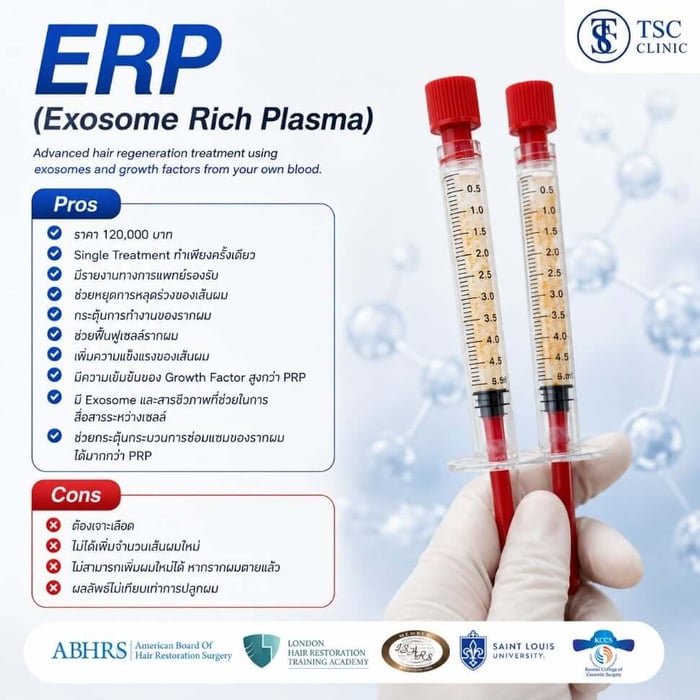 ERP (Exosome Rich Plasma)