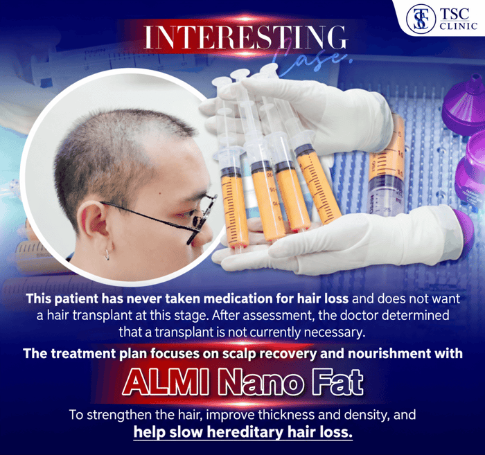 The treatment plan focuses on scalp recovery and nourishment with ALMI Nano Fat