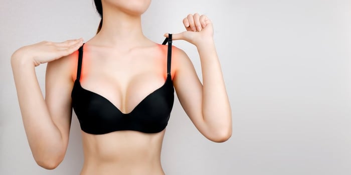 What Is Bra Strap Syndrome? (Causes & Solutions)