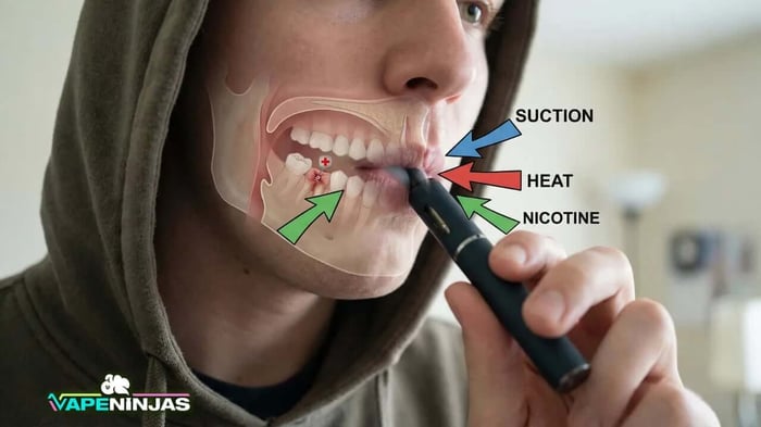 best way to vape after tooth extraction When Can I Vape After Wisdom Teeth Removal? [2026 Guide]