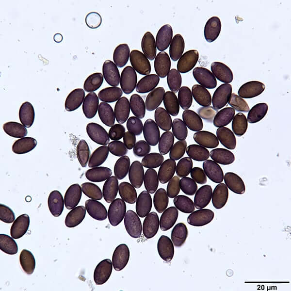 Psilocybe cubensis Penis Envy basidiospores under 400x brightfield compound microscope