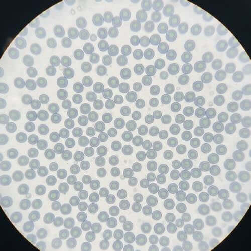 Stargazer under Microscope