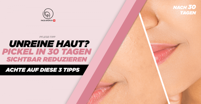 Unreine Haut? Pickel in 30 Tagen sichtbar reduzieren – Achte auf diese 3 Tipps!