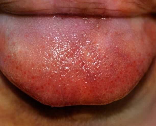 tongue lashing by nathan griffith - ugly art stock pictures, royalty-free photos & images