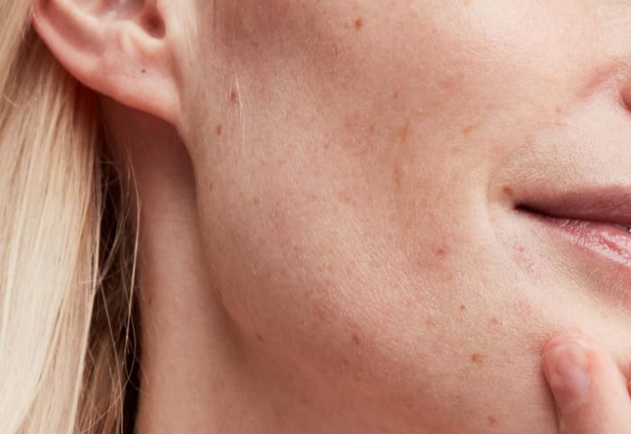Close-up of woman's face showing natural skin texture with blonde hair visible