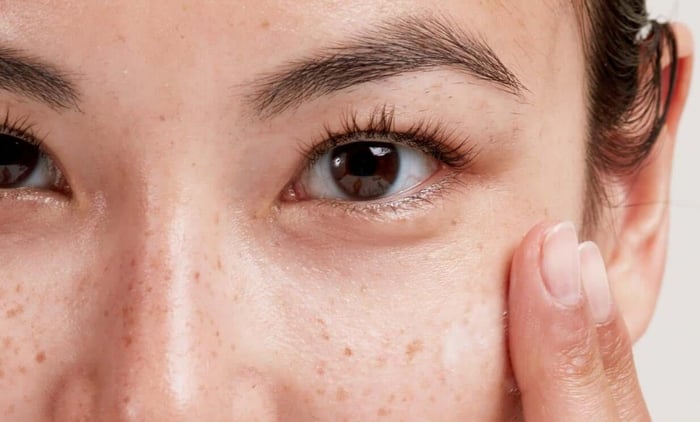 Close-up of woman's face showing freckled skin and natural complexion
