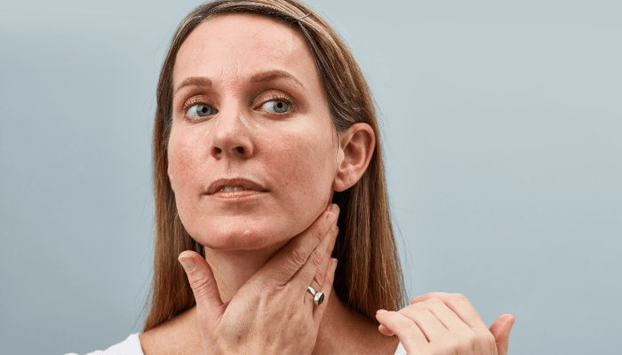 Woman with rosacea performing gentle facial massage on neck and jawline for sensitive skin care routine