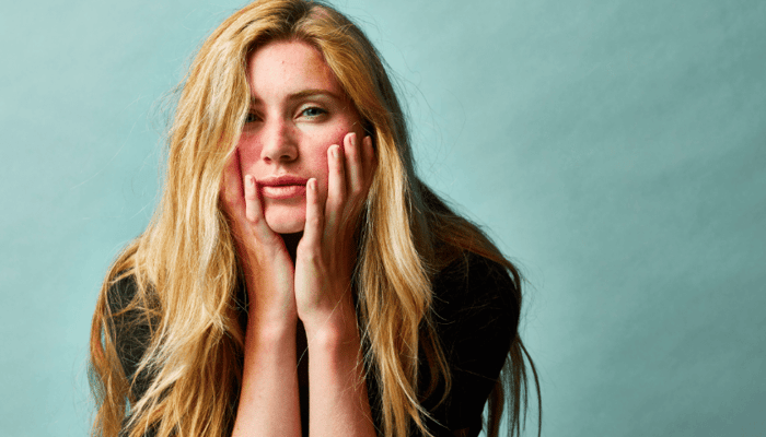 Blonde woman with rosacea-prone skin gently touching her face with both hands against sage green background