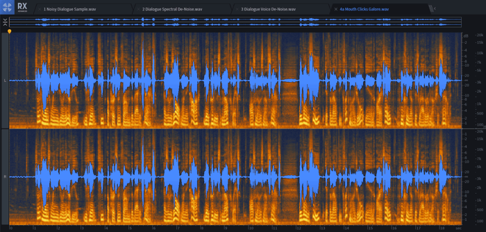 It’s hard to see the mouth clicks in this screenshot; they’re the tiny vertical lines that appear in pauses before words.