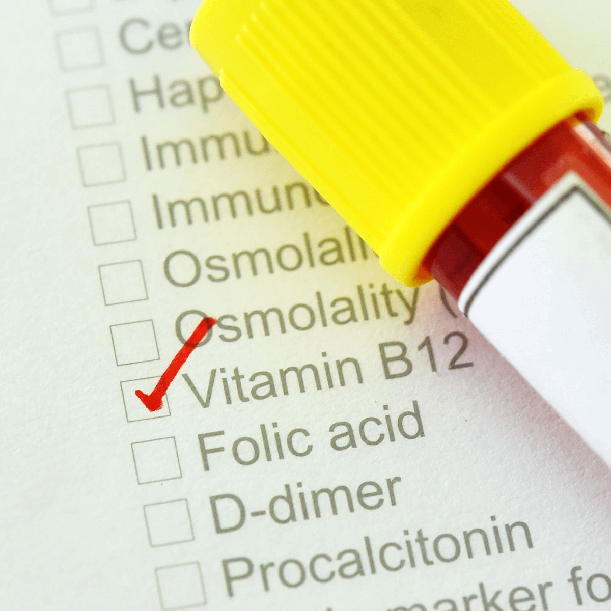 Vitamin B12 Deficiency Before & After Bariatric Surgery