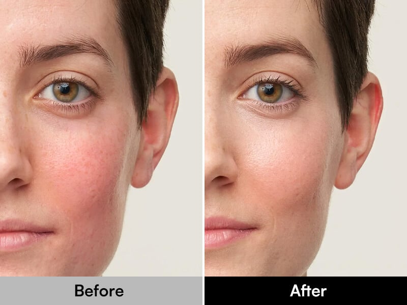 9 Benefits of Using a Red Light Mask