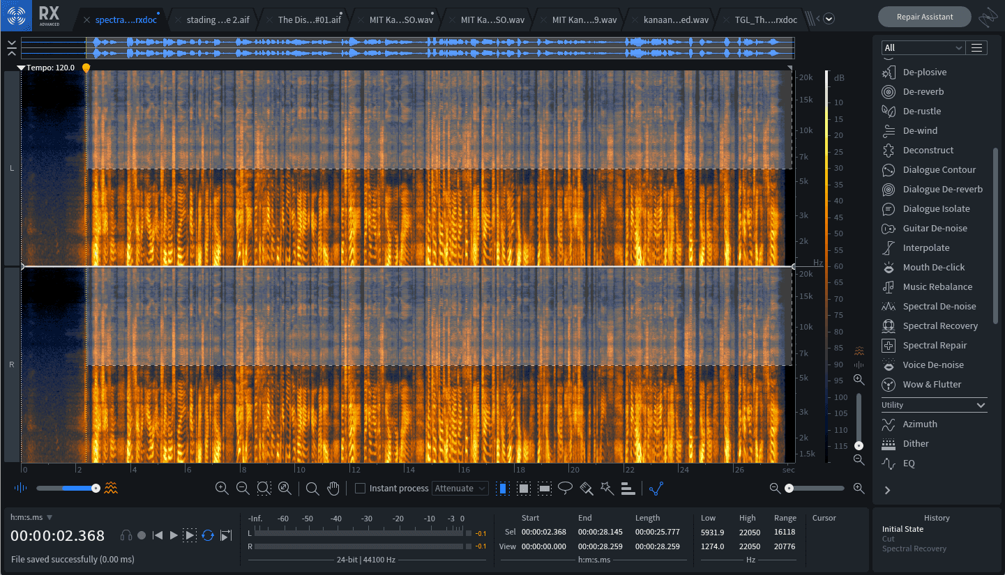 Fizzy frequencies in an actress’ recording