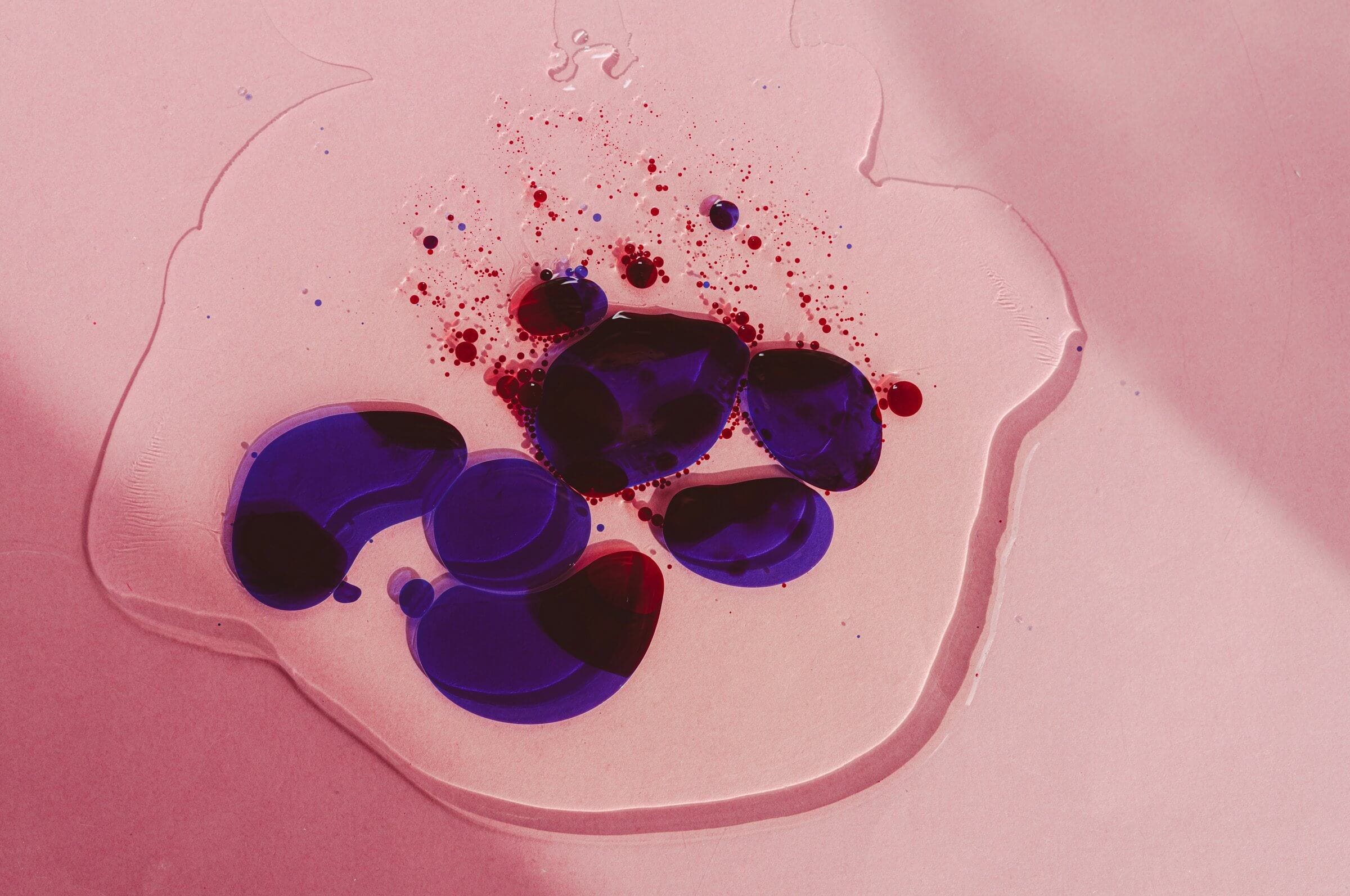bacterial bloom