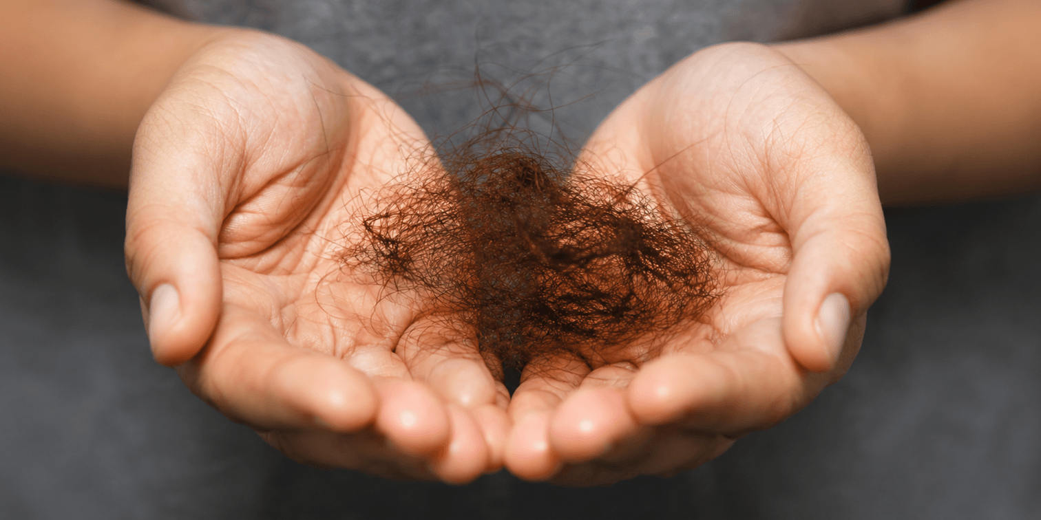 can an oily scalp cause hair loss?
