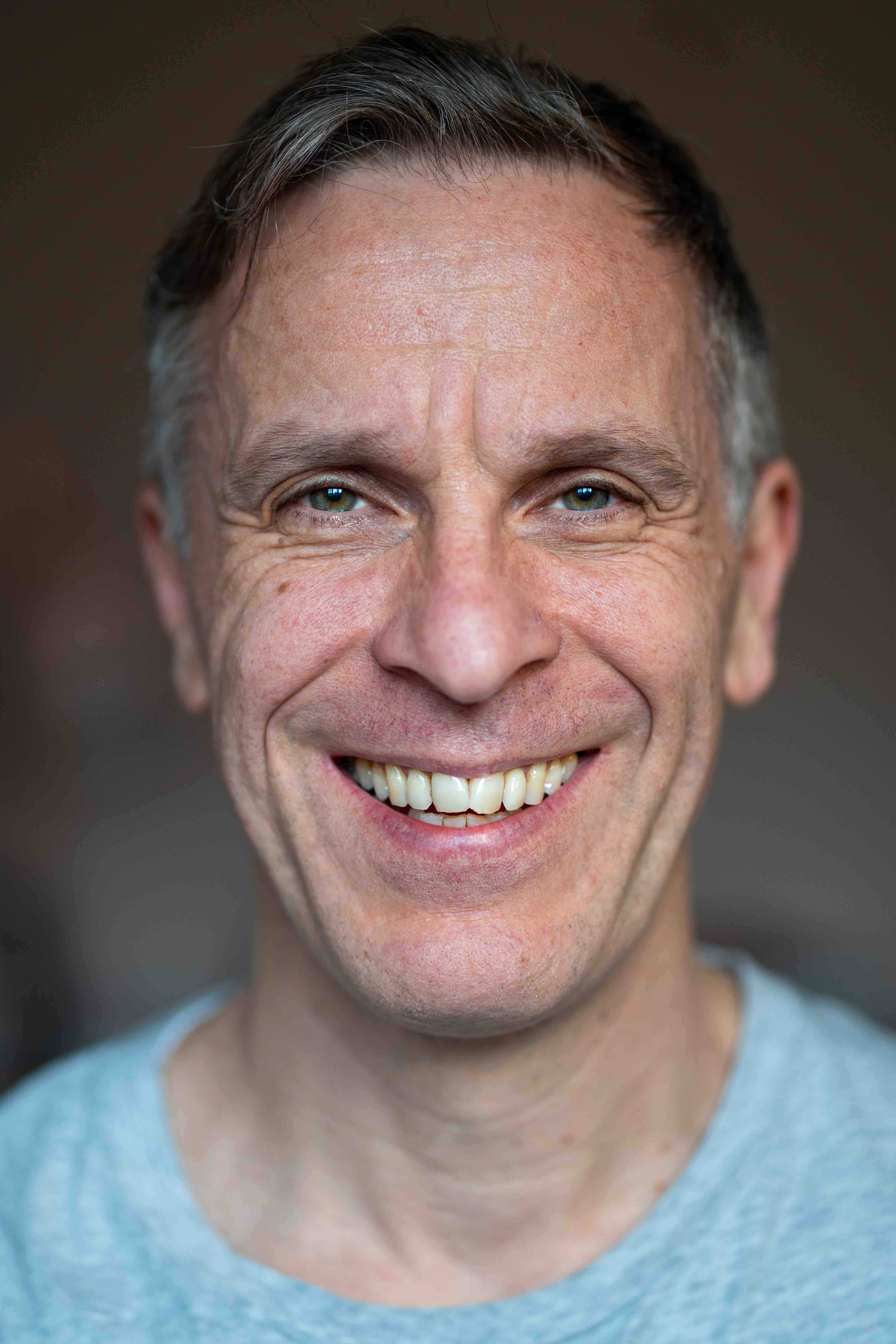 Chris Burdon