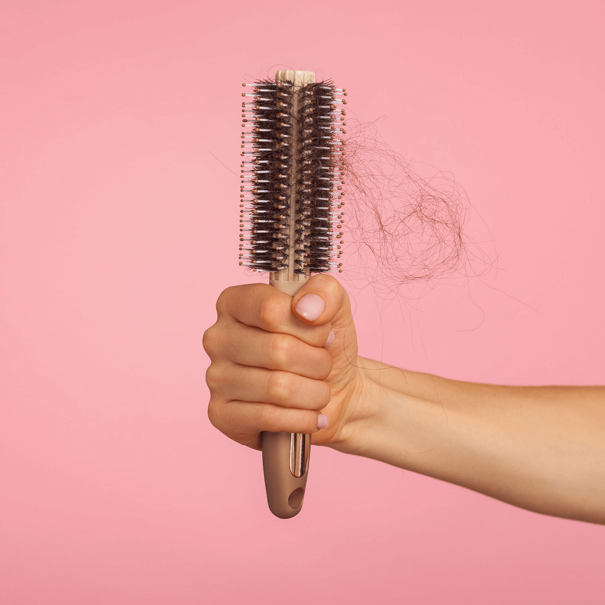Hair Loss After Weight Loss Surgery